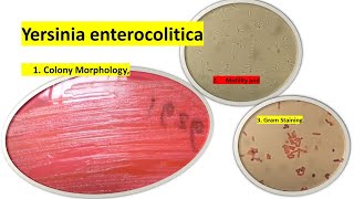 Yersinia enterocolitica colony Morphology Motility and Gram Staining [upl. by Gusba]