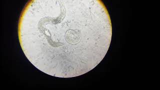 Plant parasitic Nematodes of apricotAphelenchus avenae p2 [upl. by Brunelle]