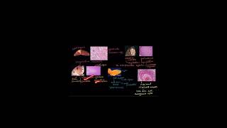 TYPES OF NECROSIS celldamage biology celldeath science cellinjury neet cellulardamage ncert [upl. by Negiam127]