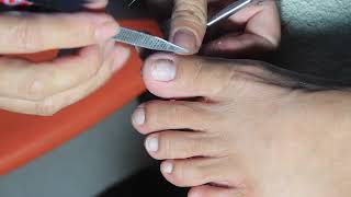 Simple Steps for Stunning Toenails A Bright and Beautiful Look [upl. by Aneerol]