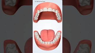 Full denture teeth procedure 3d animation🦷🥶 [upl. by Eatnod693]