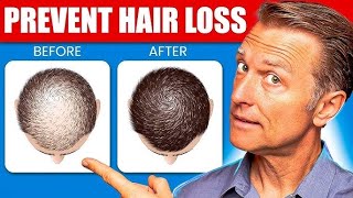 6 Proven Remedies to Prevent Hair Loss and Regrow Hair ameerht hairlosstreatment hairfall [upl. by Dunston]