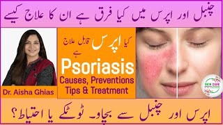 Psoriasis Explained  Symptoms Prevention Treatment amp Myths  Tips for Healthy Skin draishaghias [upl. by Nyleahcim344]