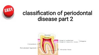 classification of periodontal disease part 2 [upl. by Sallee]