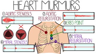 Learn Heart Murmurs In 10 Minutes With Heart Murmur Sounds [upl. by Adnovaj368]