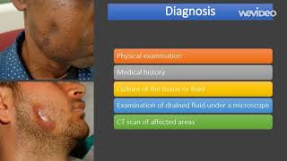 actinomycosis  causes diagnosis treatment comp [upl. by Avirt]