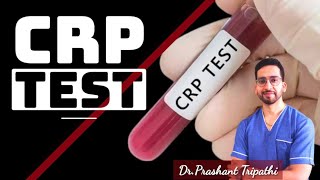 CRP TEST What is CRP  what does CRP positive mean  what is hs CRP [upl. by Kelsey361]