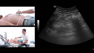 How to perform an ultrasound exam of the pancreas [upl. by Irene109]