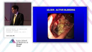 Management of Upper GI Bleeding [upl. by Chappell549]