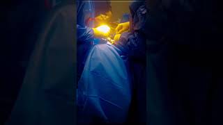 Surgery ACDF Anterior Cervical Discectomy and Fusion [upl. by Saidel]