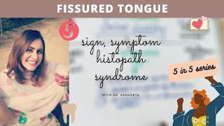 fissured tongue I oral pathology lectures [upl. by Talbot506]