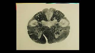 Brainstem The Medulla [upl. by Aliahs]