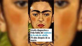 Estudio diagnostica a Frida Kahlo del síndrome de la cola de caballo 70 años después de su muerte [upl. by Robb]