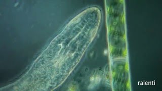 Stenostomum leucops turbellarié deau douce [upl. by Demp]