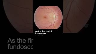 Examining the fundus – part 3 ophthalmology [upl. by Ardien]