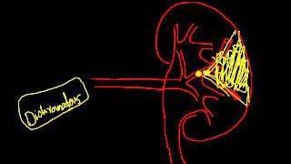 cell injury 6  types of necrosis [upl. by Nerine]