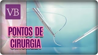 Tipos de Pontos de Cirurgia  Você Bonita 050418 [upl. by Allebasi]