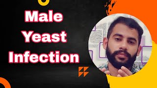 Male yeast infectionMalayalamCauses amp Treatment [upl. by Norrahc243]