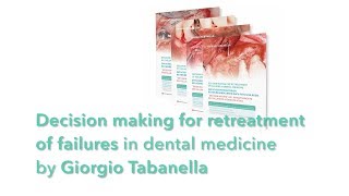 Decision making for retreatment of failures in dental medicine – Trailer [upl. by Nezah]