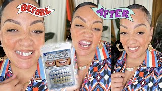 I BOUGHT A TOOTH FROM AMAZON Instant Smile Teeth Kit How I fixed My Missing Tooth Looks So Real [upl. by Eerual902]