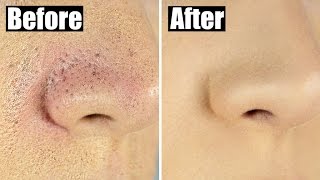 How to Reduce Bumpy Textured Foundation for Smooth Flawless Skin [upl. by Brote]