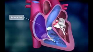 Das Herz und der „große“ Körperkreislauf des Blutes [upl. by Harsho]