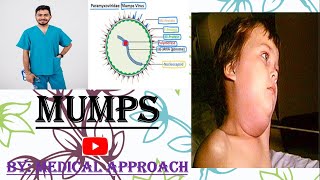 Mumps Virus  Paramyxovirus  Virology [upl. by Dihsar]