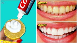 10 Des Meilleurs Moyens Pour Naturellement Blanchir Tes Dents à la Maison [upl. by Corson]