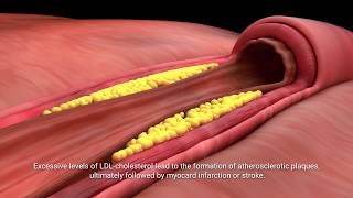 Lactobacillus plantarum INDUCIA [upl. by Jariah]