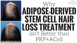 Why Adipose Derived Stem Cell Hair Loss Treatment has No Advantage over ACellPRP [upl. by Lindahl]