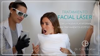 Tratamiento facial con láser [upl. by Moriah]