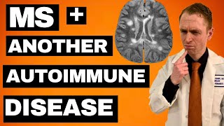 MS  Another Autoimmune Disease Treatment Options [upl. by Imoyaba]