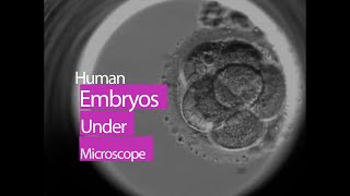 Human Embryo Under Microscope  This is How Life Begins at Conception [upl. by Adar105]