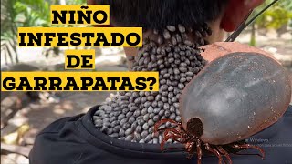 Niño con Garrapatas en la Espalda ¿Falso o Verdadero Analisis [upl. by Selena610]