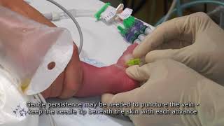 Paediatric Anaesthetics Chapter 7  Long saphenous IV neonate 1 [upl. by Leinoto]