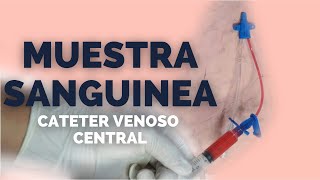 ✅Toma de MUESTRA SANGUINEA por CATETER VENOSO CENTRAL  2 técnicas FACILES 💉 [upl. by Lopez]