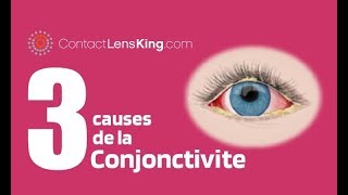 La Conjonctivite de Loeil  3 Causes de Rougeurs Dans les Yeux [upl. by Sidonie333]