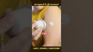 CGM Device for Diabetesyoutubeshorts factsintelugu shortvideo shortsfeed [upl. by Ejroj]