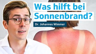 Was hilft bei Sonnenbrand Erste Hilfe Hausmittel amp Produkte aus der Apotheke  Dr Johannes Wimmer [upl. by Eiliah]