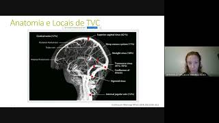 Curso Neurovascular  Trombose Venosa Cerebral Causas Incomuns e Prevenção Primordial e Primária [upl. by Llevart]