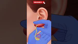 ASMR Ear Cleaning animation👂Remove dirts from your earring holes short ytshorts [upl. by Esele]