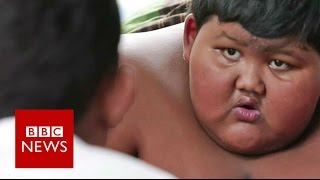 My 10yearold son weighs 188kg  BBC News [upl. by Eenaffit]