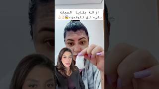 ازاله بقع الصبغة على الجلد بكل سهولة 🥰👌🏻 [upl. by Shurlocke]