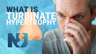 What Is Turbinate Hypertrophy  We Nose Noses [upl. by Volnak813]