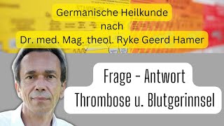 Germanische Heilkunde Frage  Antwort  Thrombose und Blutgerinnsel [upl. by Safire]