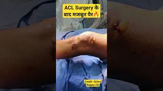 Super Strong Knee After ACL Surgery 💥aclinjury aclrecovery kneeligament anteriorcruciateligament [upl. by Bunting]