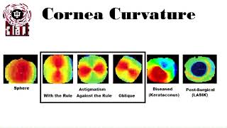 Keratometry and corneal topography [upl. by Bink]