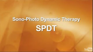 SonoDynamic Therapy for Cancer Treatment [upl. by Nhguavad]