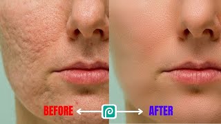 Smooth Face in Photopea  A Simple Tutorial [upl. by Bish]