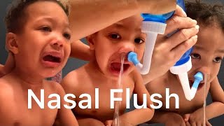 NOSE CLEANING  Nasal Flush For Kids [upl. by Gabbey858]